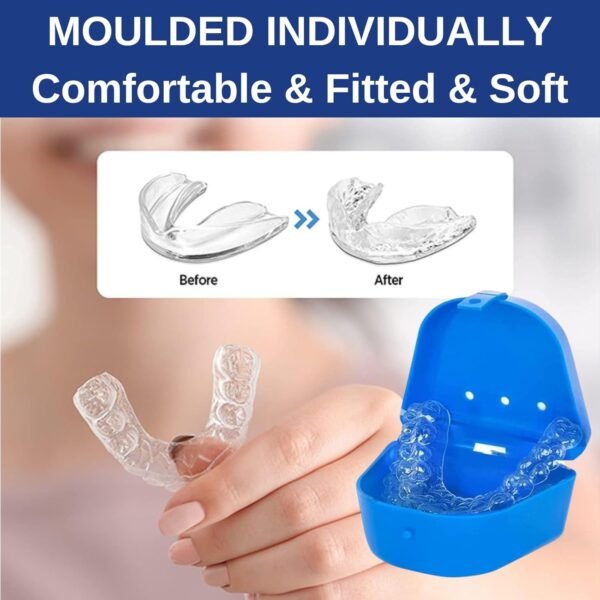 Mouth Guard for Teeth Grinding, Mouth Guard for Sleeping, Gum Shield for Teeth Grinding Guard Adults & Kids, Prevent Bruxism 4 Pcs - Image 5