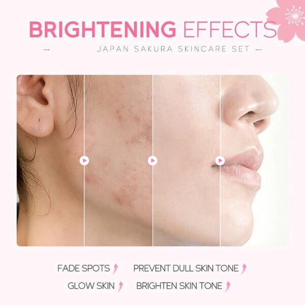 Skincare Gifts For Teenage Girls,Cherry Blossom Skincare Sets,Facial kit,Pamper Sets For Women Gifts - Image 3
