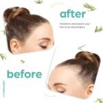 Artnaturals Organic Rosemary Castor Hair Oil + Scalp Massager Hair Growth Set Hair Growth Oil 118ml ounces - Image 2