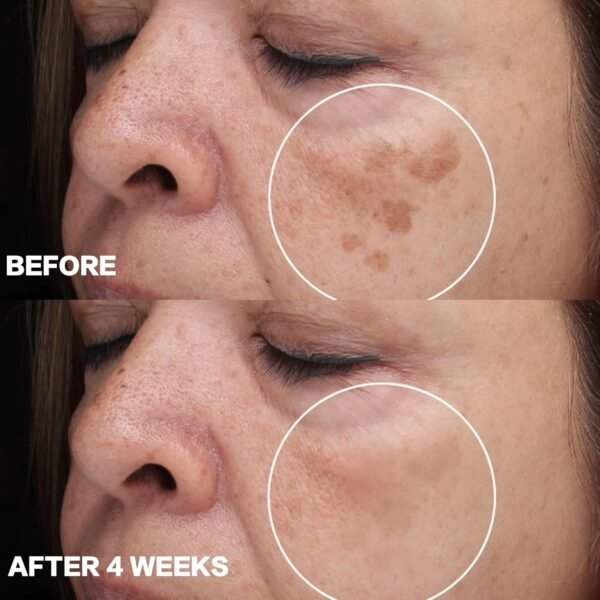 Dark Spot Remover for Face and Body: Dark Spot Corrector Cream - Enriching Skin Care for All Skin Tones - 1 fl oz - Image 6
