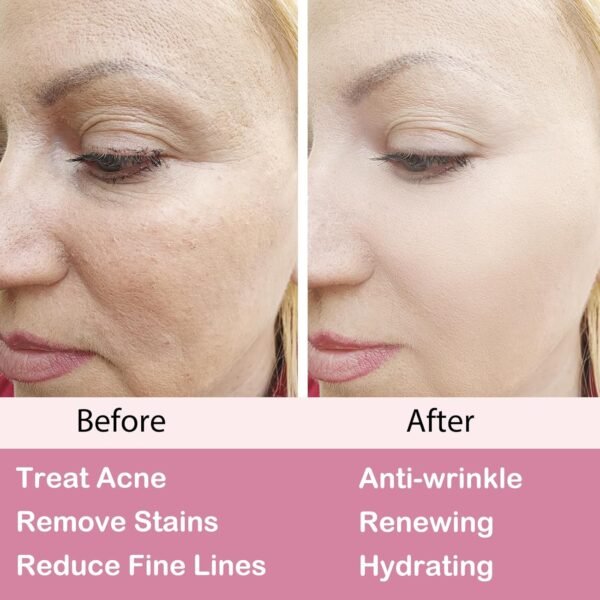 Retinol Moisturizer Cream,For Face&Eye Area Anti Aging Wrinkles & Acne & Fine Lines - With 2.5% Active Retinol (50Milliliter) - Image 5